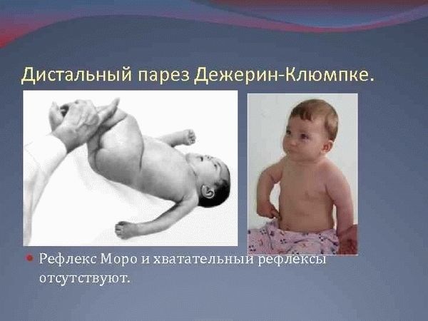 Какие права есть у родителей