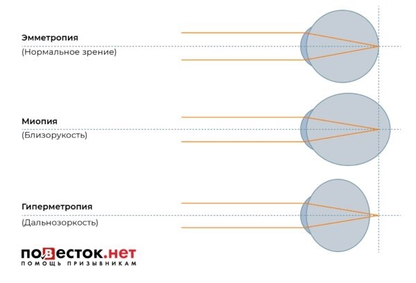 Роль зрения в армейской службе